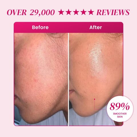EpiBella image