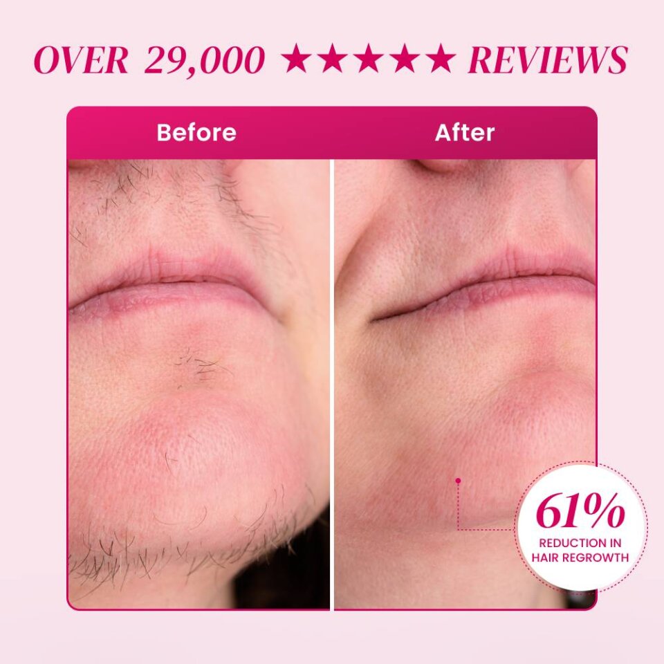 EpiBella image